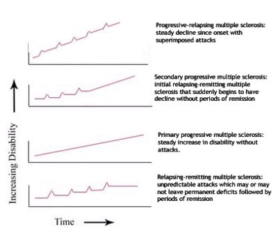 Graph representing the different types of multiple sclerosis